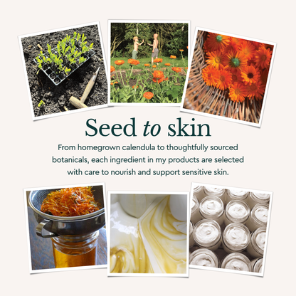 Calendula Cream for Eczema, Natural Moisturiser for Dry Skin