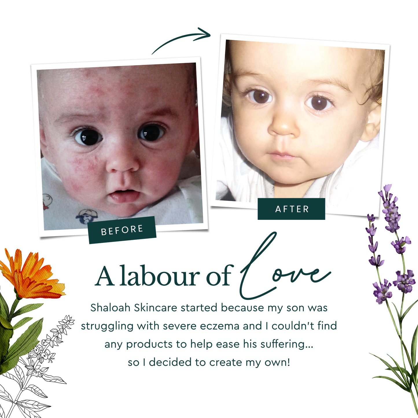 Calendula Cream for Eczema, Natural Moisturiser for Dry Skin